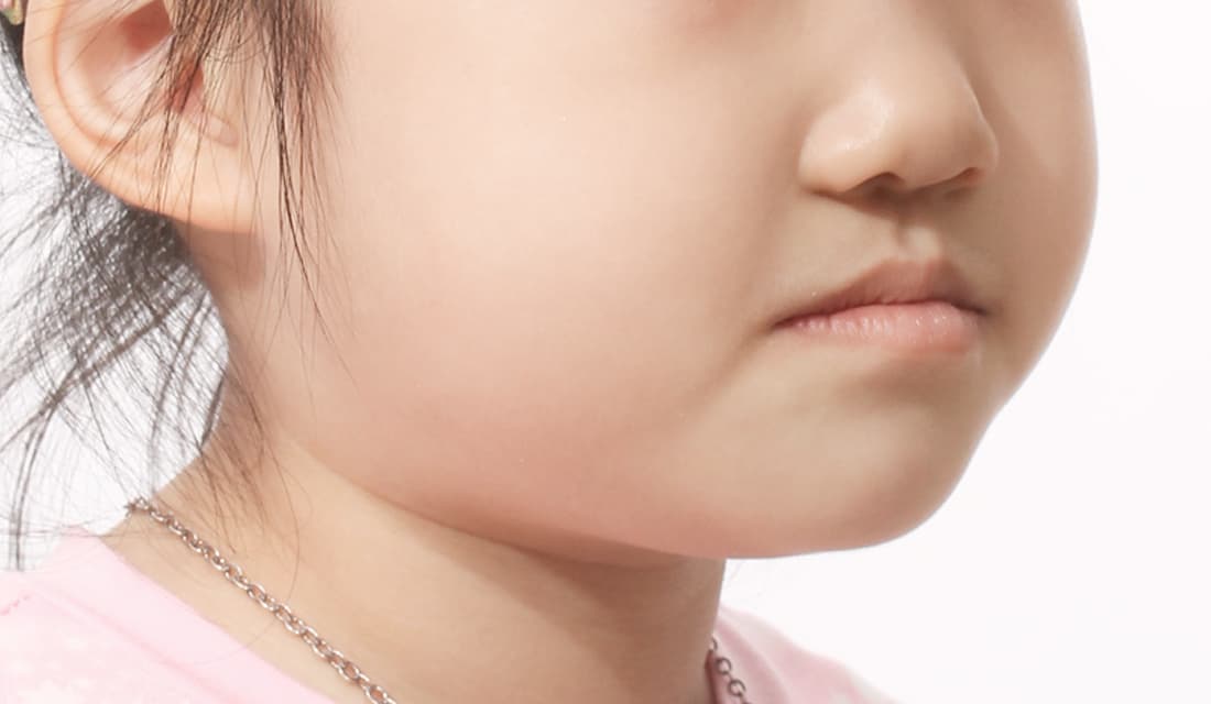 교정 치료 치료 전